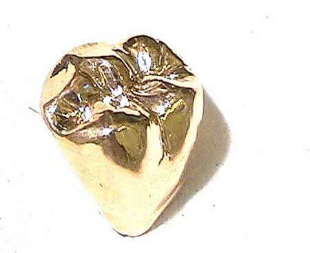 Couronne dentaire en or isolée sur fond clair
